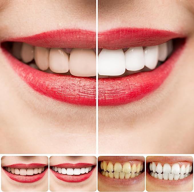 Sp-4 Breath Toothpaste,Brightening & Stain Removing Toothpaste